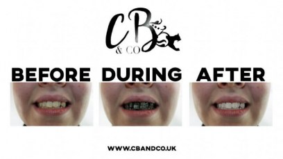 cb-co-extreme-whitening-gel-with-activated-charcoal-people