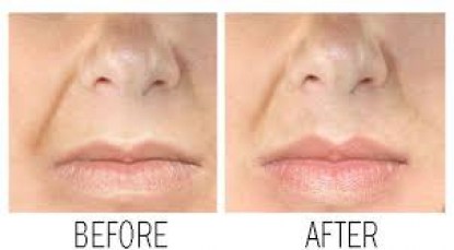 cougra-lip-plumper-real