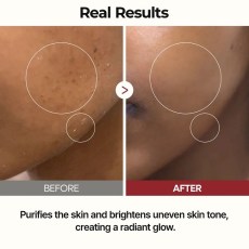 Dr.Melaxin Peel Shot Glow Rice Toner 200ml